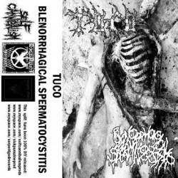 Tuco : Tuco - Blenorrhagical Spermatocystitis